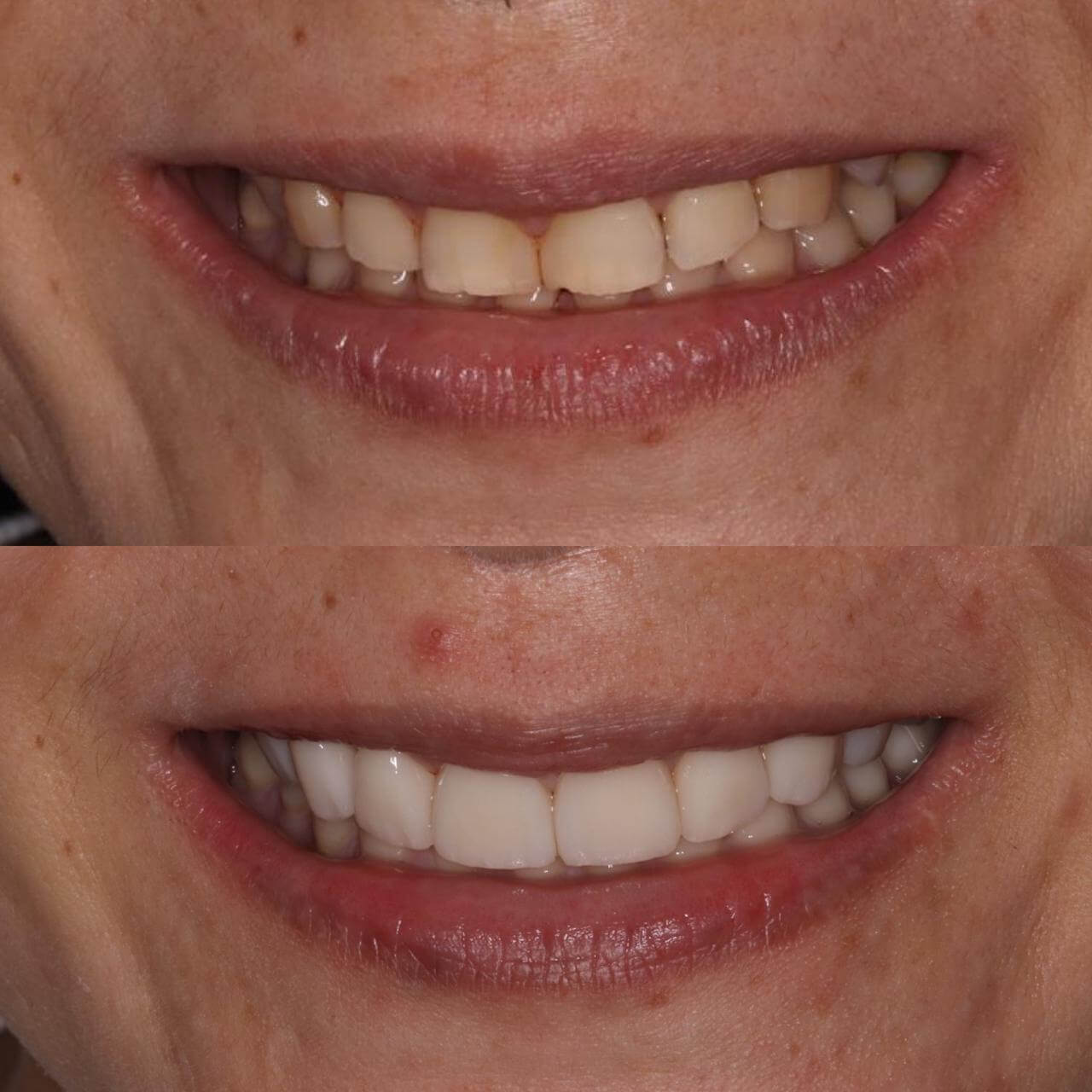 Reabilitação oral dentista