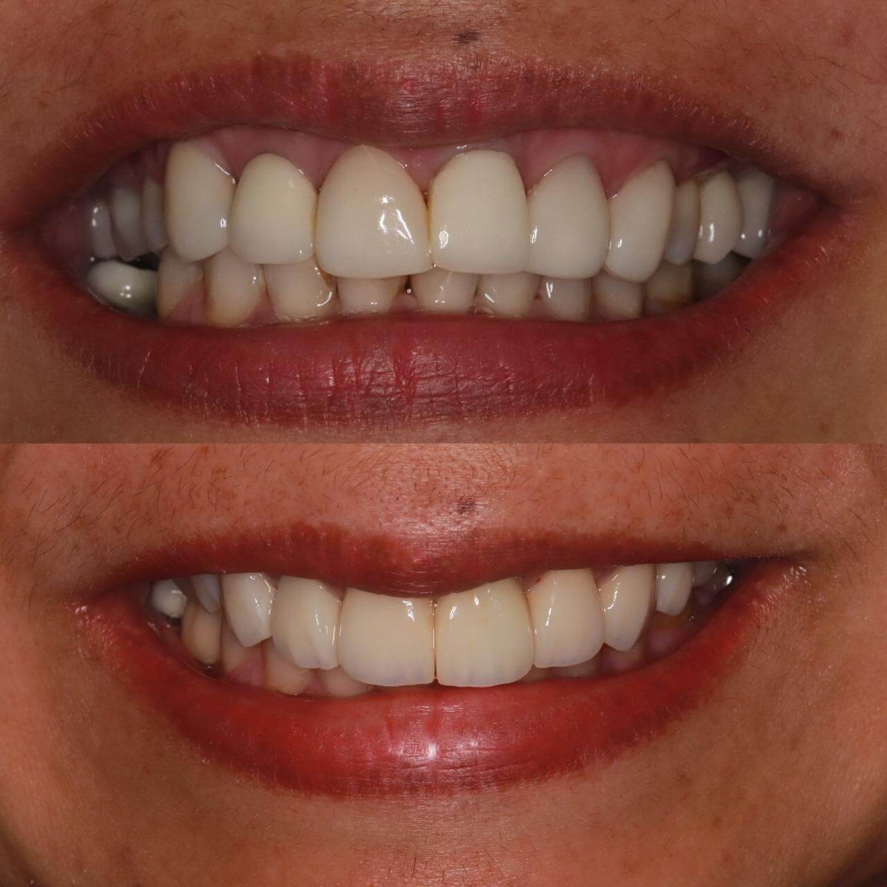 Reabilitação oral dentistas