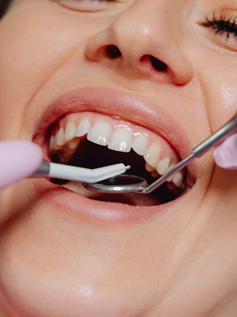 Dentista na mooca que faz clareamento dental